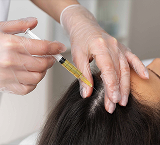 Haarmesotherapie